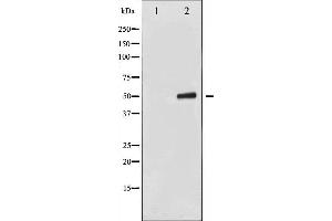 Image no. 4 for anti-Keratin 8 (KRT8) (pSer432) antibody (ABIN6255334)
