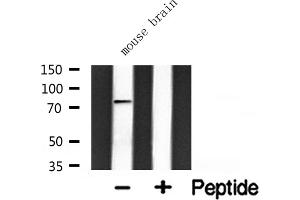 Image no. 3 for anti-G Protein-Coupled Receptor Kinase Interactor 2 (GIT2) antibody (ABIN6258206)