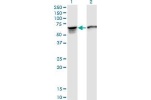 Image no. 2 for anti-Stress-Induced-phosphoprotein 1 (STIP1) (AA 1-543) antibody (ABIN524365)