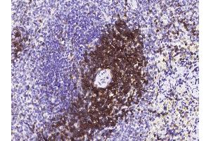 Image no. 3 for anti-CD6 (CD6) (AA 1-396) antibody (ABIN2691697)