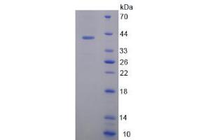 Image no. 1 for Osteocrin (OSTN) (AA 26-130) protein (His tag,GST tag) (ABIN6238257)