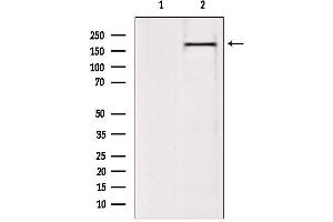 BAZ2A antibody  (N-Term)