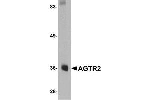 Image no. 1 for anti-Angiotensin II Receptor, Type 2 (AGTR2) (Middle Region) antibody (ABIN1030845)