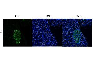 Immunofluorescence (IF) image for anti-CEACAM5 (Arcitumomab Biosimilar) antibody (ABIN5668278)