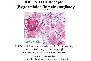 Image no. 1 for anti-Serotonin Receptor 1D (HTR1D) (2nd Extracellular Domain) antibody (ABIN1731349)
