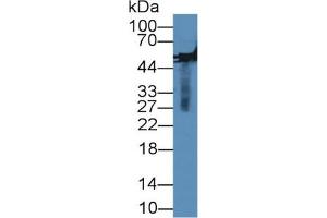 Image no. 2 for Matrix Metallopeptidase 13 (Collagenase 3) (MMP13) ELISA Kit (ABIN6720554)