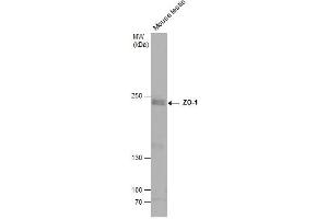 Image no. 3 for anti-Tight Junction Protein 1 (TJP1) (N-Term) antibody (ABIN2856624)