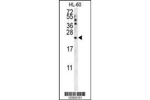 Image no. 1 for anti-Coenzyme Q Biosynthesis Protein 7 (Coq7) (AA 162-191), (C-Term) antibody (ABIN652061)