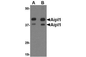 Image no. 2 for anti-Aryl Hydrocarbon Receptor Interacting Protein-Like 1 (AIPL1) (Center) antibody (ABIN499251)