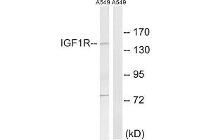 Image no. 2 for anti-Insulin-Like Growth Factor 1 Receptor (IGF1R) (Tyr1346) antibody (ABIN1848190)