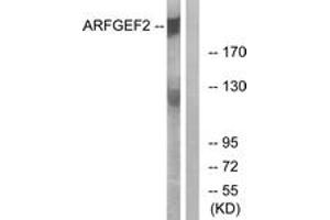Image no. 1 for anti-ADP-Ribosylation Factor Guanine Nucleotide-Exchange Factor 2 (Brefeldin A-Inhibited) (ARFGEF2) (AA 1491-1540) antibody (ABIN1534705)