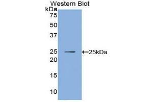 Image no. 1 for anti-Inhibitor of KB Kinase beta Interacting Protein (IKbIP) (AA 132-314) antibody (ABIN1859323)