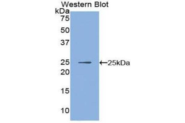 anti-Inhibitor of KB Kinase beta Interacting Protein (IKbIP) (AA 132-314) antibody