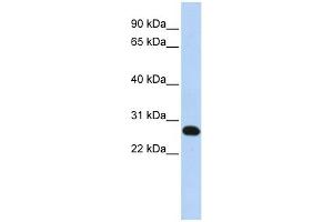 Image no. 1 for anti-Family With Sequence Similarity 119A (FAM119A) (N-Term) antibody (ABIN632190)
