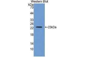 Image no. 5 for Thrombospondin 1 (THBS1) ELISA Kit (ABIN6574176)