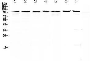 Image no. 1 for anti-Topoisomerase (DNA) I (TOP1) (AA 526-765) antibody (ABIN5692844)