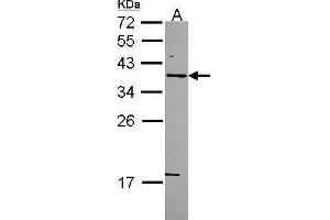 Image no. 1 for anti-Syntaxin 5 (STX5) (Center) antibody (ABIN2856972)