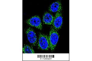 Image no. 2 for anti-MutY Homolog (E. Coli) (MUTYH) (AA 341-367) antibody (ABIN653106)