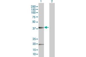 anti-Claudin 10 (CLDN10) (AA 1-228) antibody