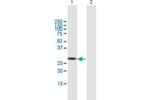 Image no. 1 for anti-Tripartite Motif Containing 72 (TRIM72) (AA 1-269) antibody (ABIN531815)