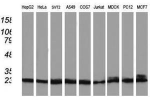 Image no. 6 for anti-Phenylethanolamine N-Methyltransferase (PNMT) antibody (ABIN1500315)