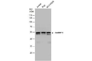 Image no. 4 for anti-Heterogeneous Nuclear Ribonucleoprotein H1 (H) (HNRNPH1) (Center) antibody (ABIN2855275)