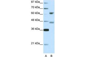 Image no. 1 for anti-Regulatory Factor X 4 (RFX4) antibody (ABIN2460674)