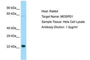MOSPD1 Antikörper  (N-Term)