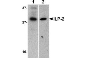 Image no. 2 for anti-Baculoviral IAP Repeat-Containing 8 (BIRC8) antibody (ABIN500020)