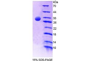 Image no. 1 for Protein tyrosine Phosphatase, Non-Receptor Type 5 (Striatum-Enriched) (PTPN5) (AA 331-558) protein (His tag) (ABIN6239265)