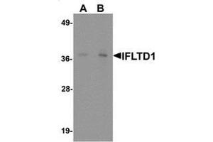 Image no. 1 for anti-Intermediate Filament Tail Domain Containing 1 (IFLTD1) (Middle Region) antibody (ABIN1450045)