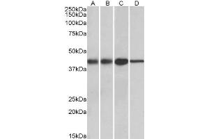 Image no. 1 for anti-Acetyl-CoA Acetyltransferase 1 (ACAT1) (AA 257-269) antibody (ABIN571082)