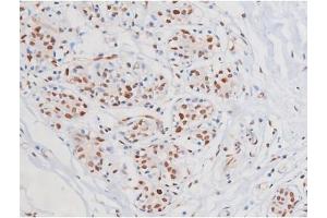 Image no. 9 for anti-Mast/stem Cell Growth Factor Receptor (KIT) (pTyr703) antibody (ABIN6255994)