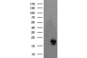 Image no. 1 for anti-NFKB Inhibitor Interacting Ras-Like 1 (NKIRAS1) antibody (ABIN1499742)