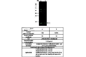 Image no. 1 for anti-Prefoldin Subunit 1 (PFDN1) (AA 1-122) antibody (ABIN6925745)