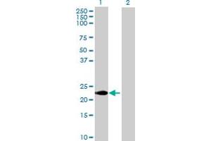 CABP7 antibody  (AA 1-215)