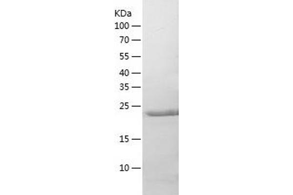 RPE Protein (AA 1-228) (His tag)