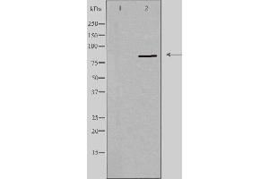 PNPLA8 Antikörper  (C-Term)