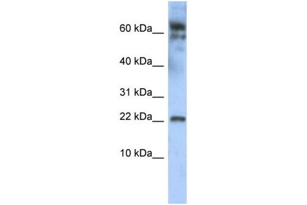 anti-Leucine Zipper, Down-Regulated in Cancer 1 (LDOC1) (N-Term) antibody
