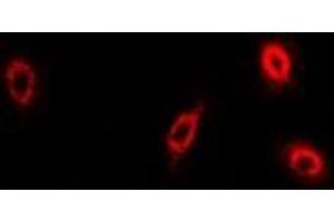 Image no. 1 for anti-Phospholipase A2, Group IID (PLA2G2D) (full length) antibody (ABIN6004382)