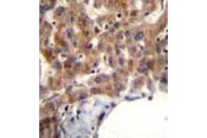 Image no. 2 for anti-Muscleblind-Like 2 (MBNL2) (AA 260-290), (C-Term) antibody (ABIN953337)