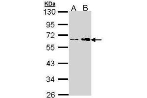 Fukutin antibody  (Center)