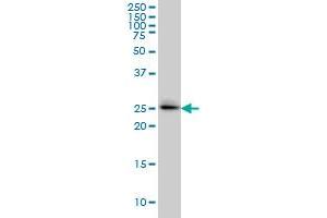 GRCC9 monoclonal antibody (M01), clone 1E6 Western Blot analysis of SPSB2 expression in A-549 .