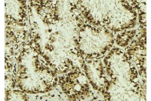 Image no. 2 for anti-Dyslexia Susceptibility 1 Candidate 1 (DYX1C1) antibody (ABIN6261407)