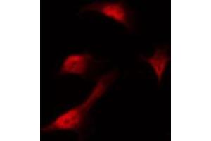 Image no. 4 for anti-CCAAT/enhancer Binding Protein (C/EBP), alpha (CEBPA) (pSer21) antibody (ABIN6256190)