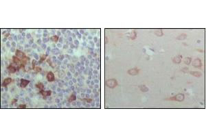 Image no. 1 for anti-EPH Receptor B6 (EPHB6) (AA 601-750) antibody (ABIN1724689)