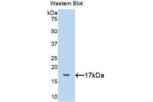anti-Pleiomorphic Adenoma Gene-Like 1 (PLAGL1) (AA 226-362) antibody