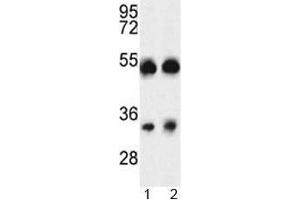Image no. 2 for anti-ORAI Calcium Release-Activated Calcium Modulator 1 (ORAI1) (AA 145-173) antibody (ABIN3028904)