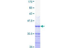 Image no. 1 for ATPase, Ca++ Transporting, Plasma Membrane 4 (ATP2B4) (AA 1-92) protein (GST tag) (ABIN1346043)