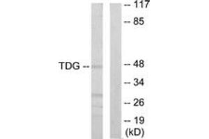 Image no. 1 for anti-Thymine-DNA Glycosylase (TDG) (AA 31-80) antibody (ABIN1533874)